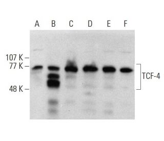 western blotting image from recommended TCF-4 (D-4) monoclonal antibody replacement. Image 376874