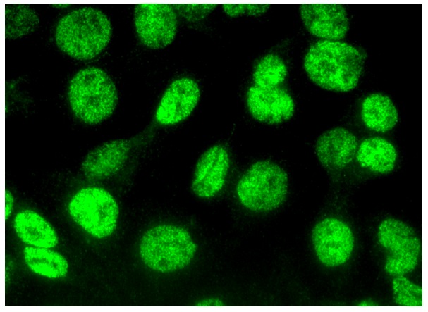 TCF7L2/TCF4抗体(D-4) | SCBT - Santa Cruz Biotechnology