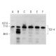 western blotting image from recommended TCF-4 (D-4) monoclonal antibody replacement. Image 376874