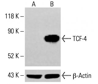TCF7L2/TCF4 Antibody (H-7) - Western Blotting - Image 413932