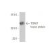 TCIRG1 Antibody (6H3) - Western Blotting - Image 349022