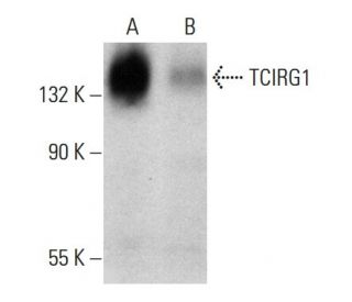 TCIRG1 Antibody (6H3) - Western Blotting - Image 384073 