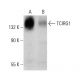 TCIRG1 Antibody (6H3) - Western Blotting - Image 384073 