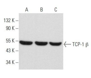 western blotting image from recommended TCP-1 β (D-8) monoclonal antibody replacement. Image 357936