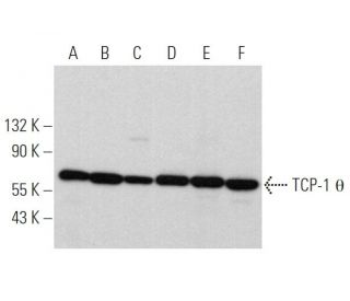 western blotting image from recommended TCP-1 &theta; (E-7) monoclonal antibody replacement. Image 367403