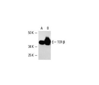 western blotting image from recommended TCR &beta; (G-11) monoclonal antibody replacement. Image 4998