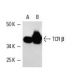 western blotting image from recommended TCR β (G-11) monoclonal antibody replacement. Image 4998
