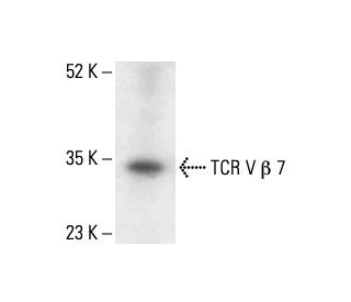 TCR V &beta; 7 Antibody (3H3005) - Western Blotting - Image 411911 