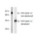 TCR V β 8.1-2 Antibody (KJ16) - Western Blotting - Image 38338