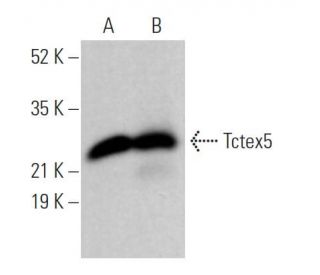 Tctex5 Antibody (D-9) - Western Blotting - Image 372060 