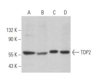 TDP2 Antibody (16) - Western Blotting - Image 365093 