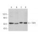 TDP2 Antibody (16) - Western Blotting - Image 365093 