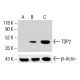 TDP2 Antibody (16) - Western Blotting - Image 413406