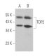 TDP2 Antibody (H-6) - Western Blotting - Image 364074 