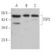 TDP2 Antibody (H-6) - Western Blotting - Image 364078
