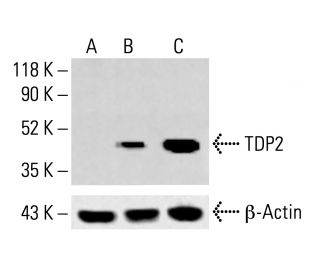 TDP2 Antibody (16) - Western Blotting - Image 413406