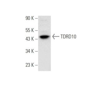 TDRD10 Antibody (D-4) - Western Blotting - Image 305685 