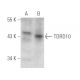 TDRD10 Antibody (D-4) - Western Blotting - Image 389002
