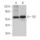 TdT Antibody (B-9) - Western Blotting - Image 366826 