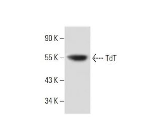 TdT Antibody (C-11) | SCBT - Santa Cruz Biotechnology