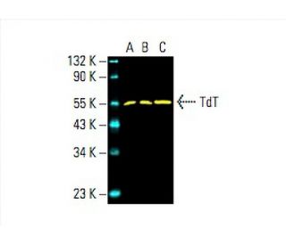 TdT Antibody (C-11) - Western Blotting - Image 392424Each CRISPR/Cas9 Knockout (KO) Plasmid product consists of a pool of 3 plasmids designed to ensure identification and cleavage of a specific gene for maximum knockout efficiency. Each plasmid encodes a unique 20 nt sequence derived from the GeCKO (v2) library.