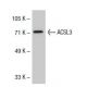 ACSL3 (N-12): sc-47993. Western blot analysis of ACSL3 expression in TE671 whole cell lysate.