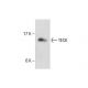 TECK Antibody (YY05) - Western Blotting - Image 286815