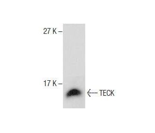 TECK Antibody (YY05) - Western Blotting - Image 287568 