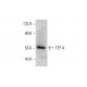 TEF-4 Antibody (404C5a) - Western Blotting - Image 384282