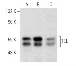 western blotting image from recommended TEL (E-1) monoclonal antibody replacement. Image 357330