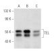 western blotting image from recommended TEL (E-1) monoclonal antibody replacement. Image 357330