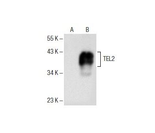 TEL2 Antibody (F-8) - Western Blotting - Image 154097
