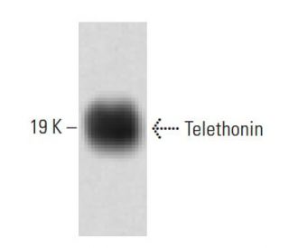 Telethonin Antibody (53) - Western Blotting - Image 60469