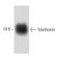 Telethonin Antibody (53) - Western Blotting - Image 60469
