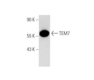 TEM7 Antibody (4H260) - Western Blotting - Image 65763