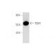 TEM7 Antibody (4H260) - Western Blotting - Image 65763