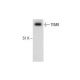 TEM8 Antibody (200C1339) - Western Blotting - Image 287169