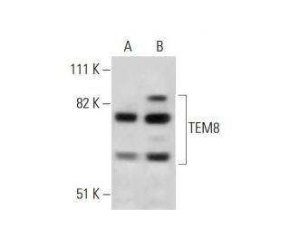TEM8 Antibody (200C1339) - Western Blotting - Image 290038 