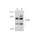 TEM8 Antibody (200C1339) - Western Blotting - Image 290038 