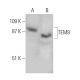 TEM8 Antibody (4H261) - Western Blotting - Image 368232