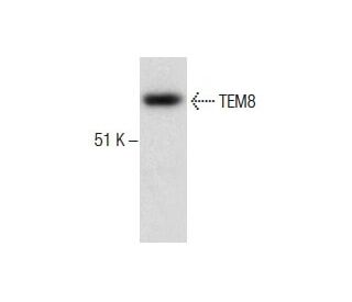 TEM8 Antibody (4H261) - Western Blotting - Image 287170