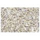 Tenascin-C Antibody (E-9) - Immunohistochemistry - Image 13285 