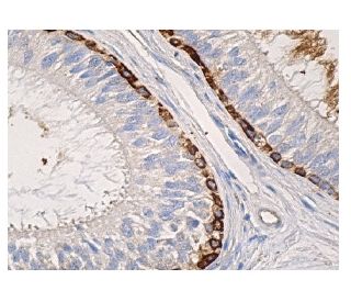 immunohistochemistry image from recommended Tenascin-C (E-9) monoclonal antibody replacement. Image 156801