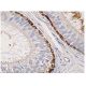 immunohistochemistry image from recommended Tenascin-C (E-9) monoclonal antibody replacement. Image 156801
