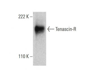 Tenascin-R Antibody (A-2) - Western Blotting - Image 384498SAM Transcription Activation: SAM system utilizing dCas9-VP64, MS2-P65-HSF1, and sgRNA for precise gene transcription activation. 