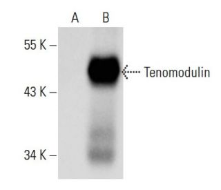 Tenomodulin Antibody (A-2) - Western Blotting - Image 396628 