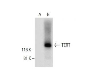 tert-antibody-a-6-western-