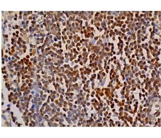 immunohistochemistry image from recommended TERT (A-6) monoclonal antibody replacement. Image 349116