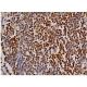 Este anticuerpo policlonal ha dejado de fabricarse. Consulta nuestro anticuerpo monoclonal recomendado <a href="tert-antibody-a-6">TERT (A-6)</a> (se muestran datos de muestra). immunohistochemistry image from recommended TERT (A-6) monoclonal antibody replacement. Image 349116