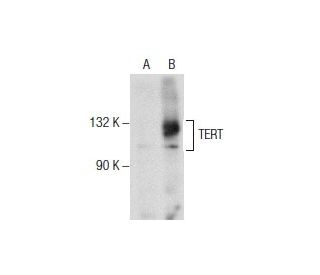 TERT (C-12): sc-377511. Western blot analysis of TERT expression in... 